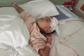 Địa chỉ vàng: Các bệnh viện cấp cứu đột quỵ trẻ em