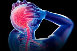 Chuyên gia cảnh báo loại thực phẩm dễ gây đột quỵ