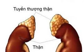 Dấu hiệu phát hiện sớm suy thượng thận cấp