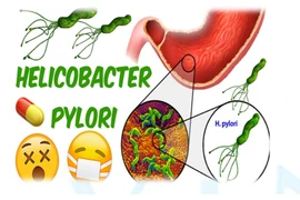 Có cần phải quá lo lắng với vi khuẩn H.P?