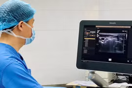 Địa chỉ vàng: Bệnh viện khám và mổ u tuyến giáp uy tín ở Hà Nội