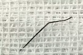 Nuốt ghim hồ sơ dài 2cm, cô gái 24 tuổi bị thủng ruột non