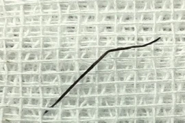 Nuốt ghim hồ sơ dài 2cm, cô gái 24 tuổi bị thủng ruột non