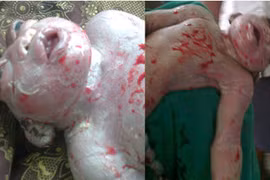 Kỳ dị em bé nửa người nửa ếch