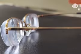 Khó tin: Người phụ nữ cận 3.000 độ, nhãn cầu như quả bóng