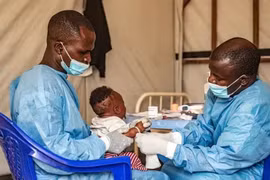 Dịch bệnh lạ ở Congo, Bộ Y tế nói gì?