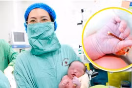 Bé trai nặng 3,8 kg chào đời cùng vòng tránh thai của mẹ