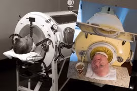 Người đàn ông sống trong 'lá phổi sắt' lâu nhất lịch sử 