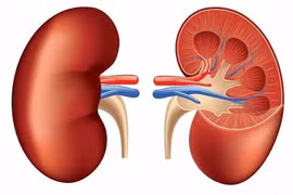 Kỳ lạ quả thận người đàn ông ở Tuyên Quang nằm lạc chỗ 61 năm