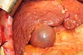 8 điều cần nhớ về bệnh ung thư đáng sợ nhất