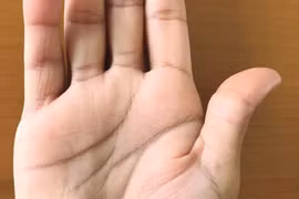 Đến nha sĩ kiểm tra đơn giản, tá hỏa phát hiện nhiễm trùng có thể tử vong 