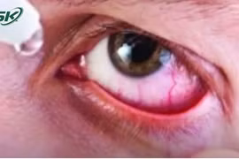 Bé trai mù một bên mắt vì nhỏ sữa mẹ chữa viêm mắt