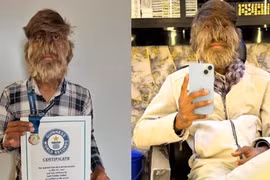 Chấn động "người sói" Ấn Độ ghi danh vào Kỷ lục Thế giới