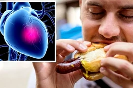 Những cái chết quái lạ, bất ngờ chỉ vì... ăn