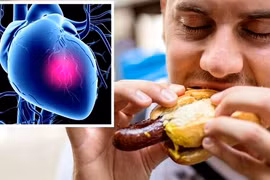 Những cái chết quái lạ, bất ngờ chỉ vì... ăn