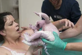 Ảnh em bé chào đời vẫn nằm nguyên trong túi ối 