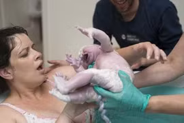 Ảnh em bé chào đời vẫn nằm nguyên trong túi ối 