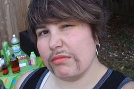 Khi phụ nữ mọc ria mép 