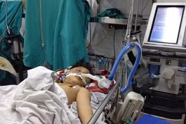 Cháu bé bị bố dùng điếu cày đánh đã qua đời