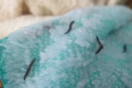 Xét nhiệm ấu trùng trong khăn tắm Trung Quốc