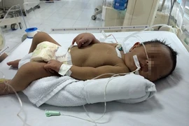 Cứu sống bệnh nhi 2 giờ tuổi bị bệnh hiếm gặp