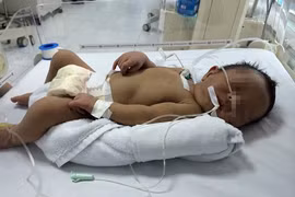 Cứu sống bệnh nhi 2 giờ tuổi bị bệnh hiếm gặp