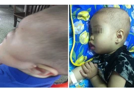 Xót lòng bệnh nhi bị ung thư máu hiếm gặp