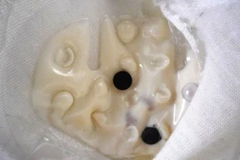 Những “vật thể lạ” trong áo ngực khiến chị em khiếp vía