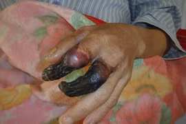 Những căn bệnh “giết người” hàng loạt