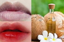 Bật mí 4 cách 'đánh bay' thâm môi bằng dầu dừa hiệu quả, an toàn