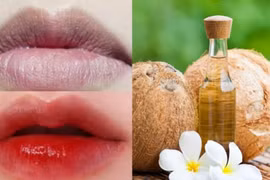 Bật mí 4 cách 'đánh bay' thâm môi bằng dầu dừa hiệu quả, an toàn