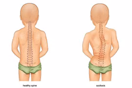 10 thói quen ‘hủy hoại’ cổ và lưng bạn cần sửa ngay