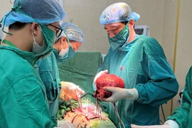 Đi khám vì rong kinh, bụng to người phụ nữ phát hiện u xơ tử cung