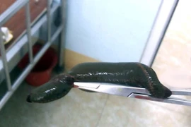 Bắt ốc dưới ao, cụ ông 71 tuổi bị đỉa chui vào bộ phận "nhạy cảm"