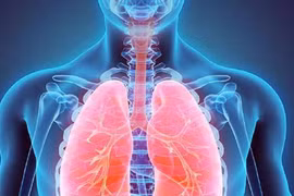 5 loại trái cây được ví như 'máy hút bụi' dành cho phổi