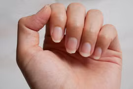8 dấu hiệu bất thường trên móng tay cảnh báo tình trạng sức khỏe