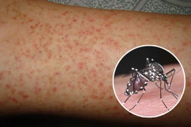 Số ca mắc sốt xuất huyết tại Hà Nội gia tăng so với những tuần trước