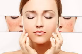 Bí quyết chăm sóc da nhạy cảm không phải ai cũng biết