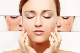 Bí quyết chăm sóc da nhạy cảm không phải ai cũng biết