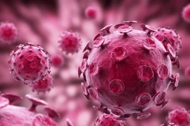 Hôn người lạ ở quán bar, nam thanh niên mắc sùi mào gà ở chân răng