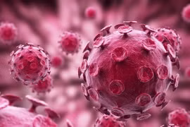 Hôn người lạ ở quán bar, nam thanh niên mắc sùi mào gà ở chân răng