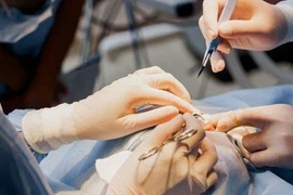 Đánh cược sức khỏe, tính mạng chạy theo cái đẹp