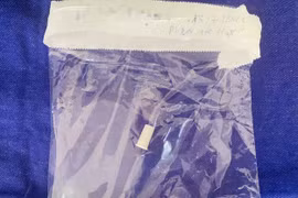 Hít thở ra tiếng còi kêu phát hiện dị vật ở cổ họng bé 6 tuổi