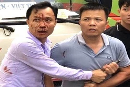 Tài xế xe khách đánh người như côn đồ - Sở GTVT xử lý thế nào?