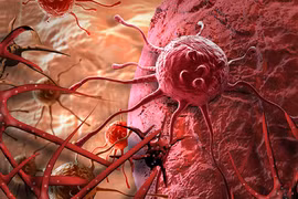 Ung thư sẽ tránh xa khi bạn duy trì 10 thói quen tốt này