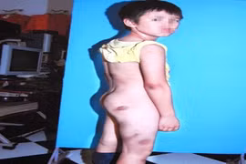 Mẹ kế đánh con chồng và chồng nhập viện