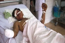 Vật lạ trên rẫy phát nổ lớn hai cha con suýt chết