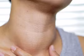 Suy tim, nhiễm khuẩn huyết vì bệnh Basedow