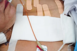 Kích hoạt báo động đỏ cứu người phụ nữ bị đâm 17 nhát