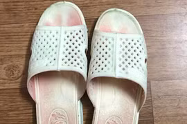 Căng thẳng, stress… nguy cơ hội chứng mồ hôi máu